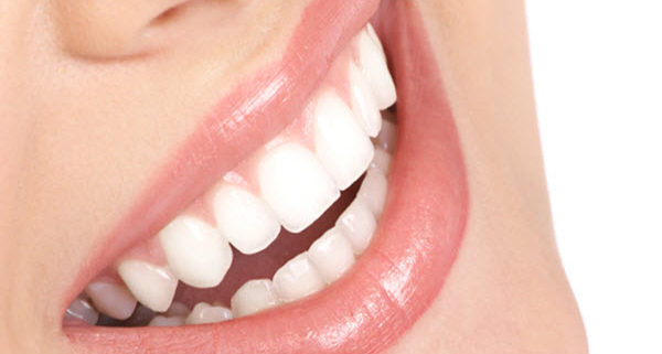 at-home whitening